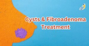 Fibroadenoma Best Treatment Center at Hyderabad
